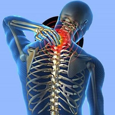 Дарди гардан бо остеохондрозҳои бачадон