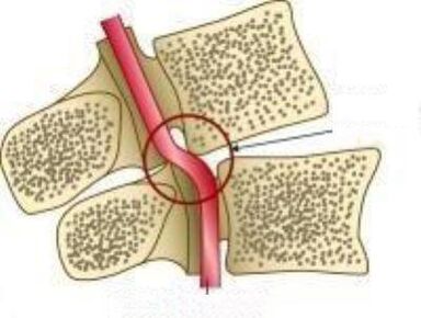 Синдроми сурх