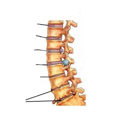 Чӣ гуна остхеохондроз рушд мекунад
