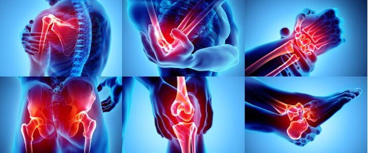 Пайвандҳои илтиҳоб